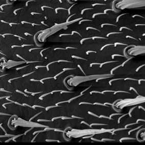蠅類背部微毛，電子顯微鏡照片